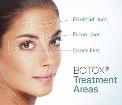 Botox1