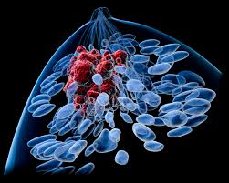 Breast_Cancer_Therapy_Market1