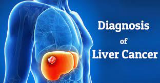 Liver_Cancer_Diagnostics_Market