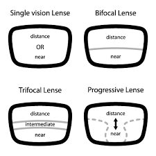 Presbyopia_Treatment