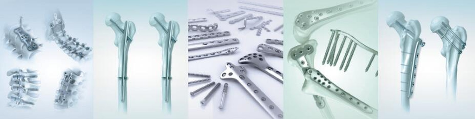Small_Bone_And_Joint_Orthopedic_Devices_Market