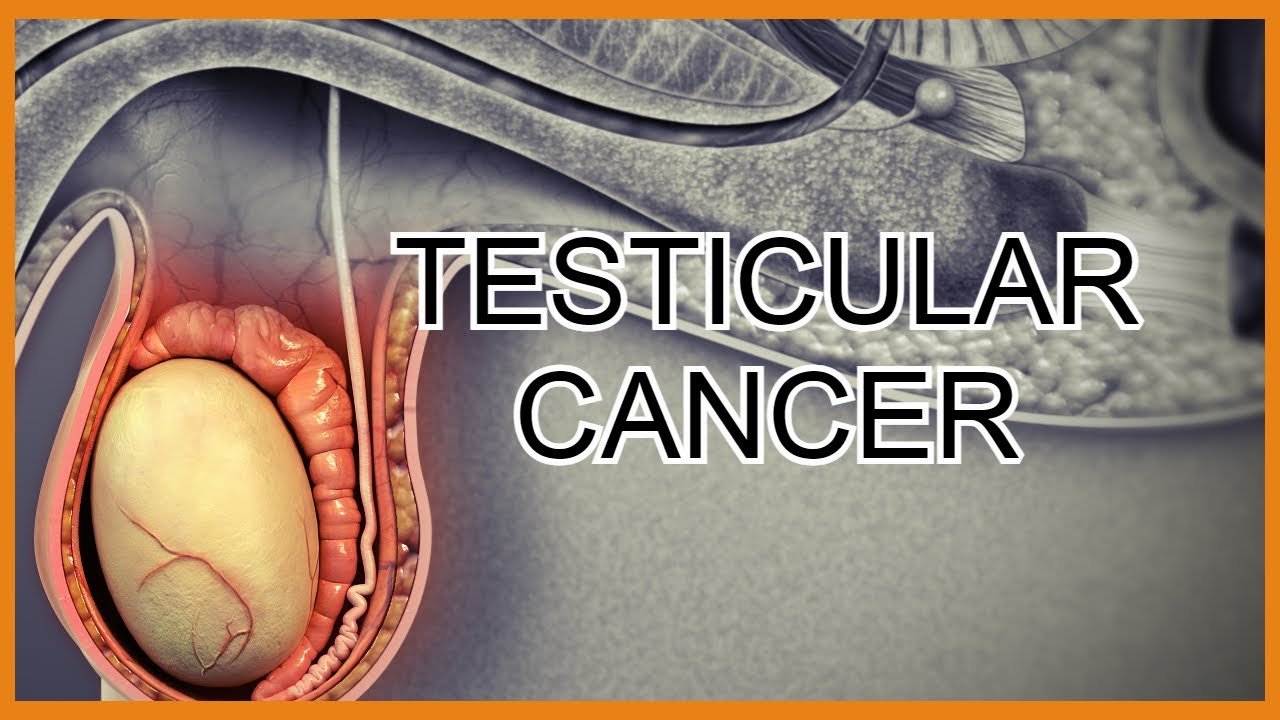 Testicular_Cancer_Drugs