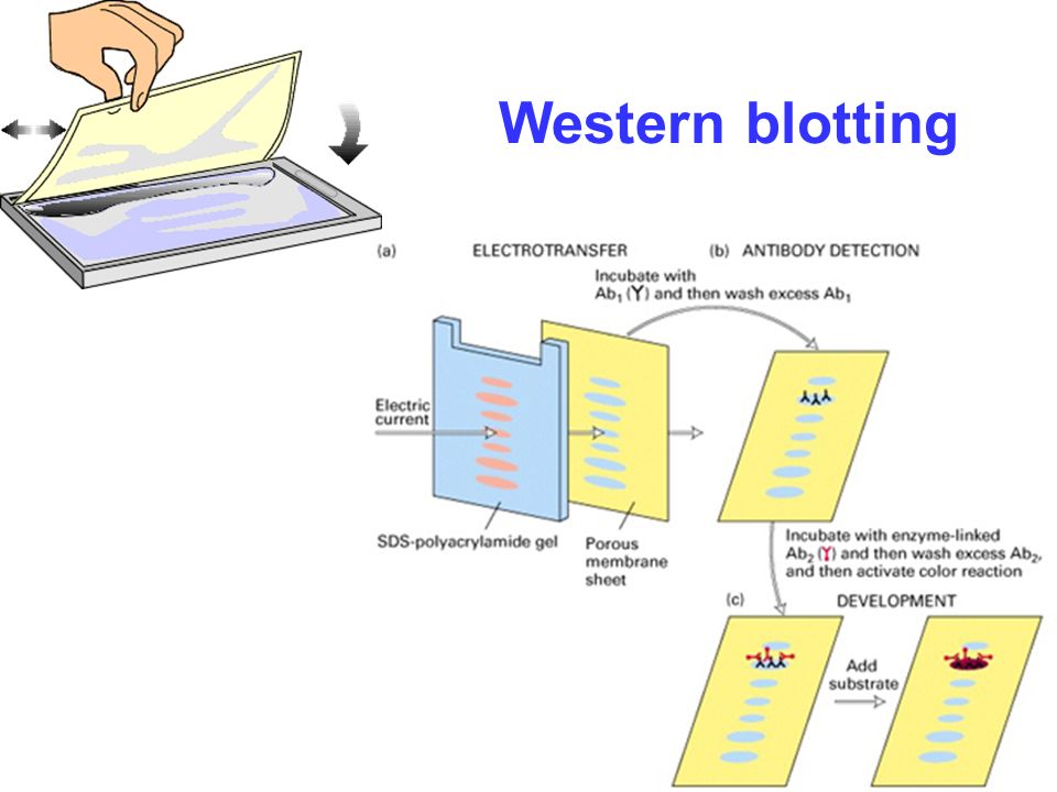 Western_Blotting_Industry