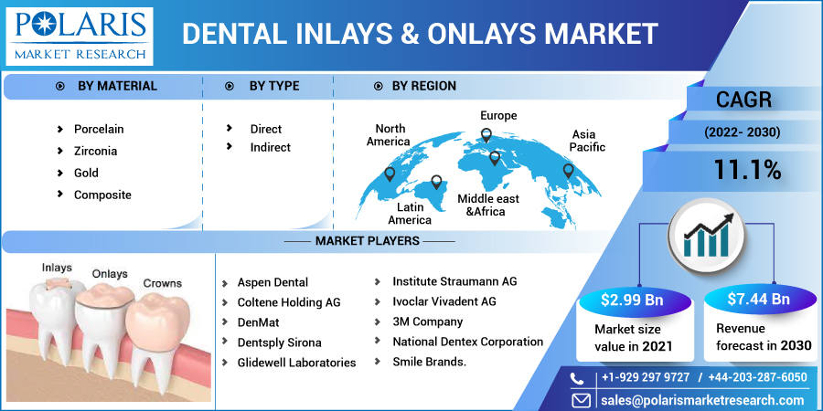 Dental_Inlays_Onlays_Market10