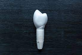 Dental_Zirconia_Implant