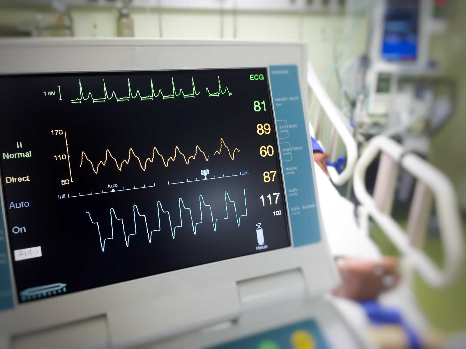 Electrocardiograph_(ECG)