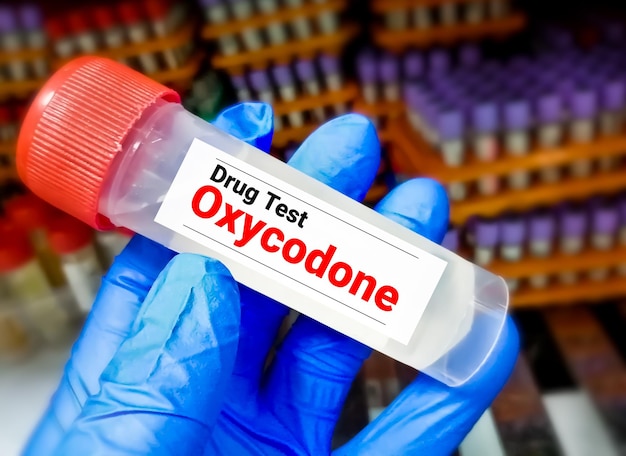 Oxycodone_Market