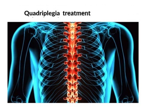 Quadriplegia_Treatment